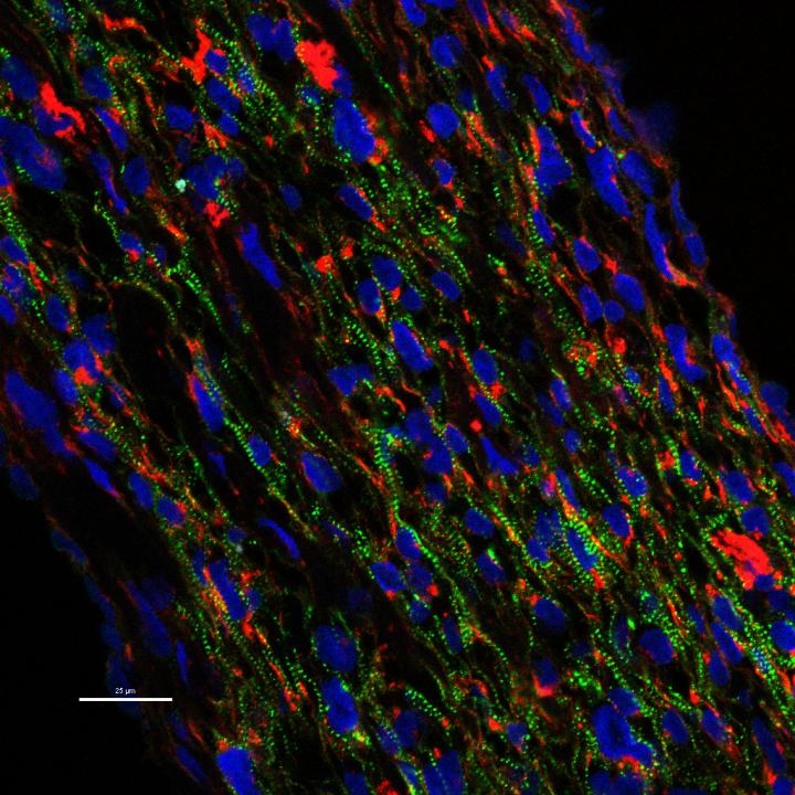 Engineering Healthier Hearts