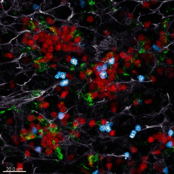 In the Lymph Node