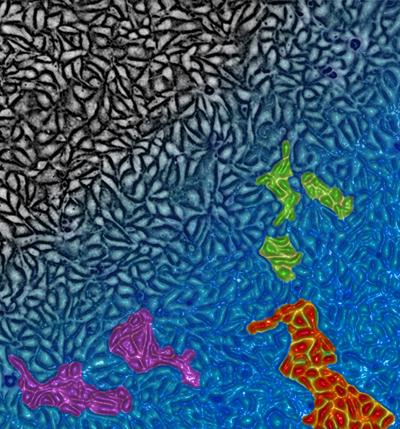 Epithelial Cells (Black) Approaching the Glass Transition (Blue)