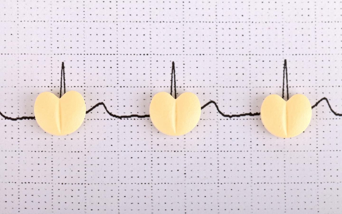 Afib Photo