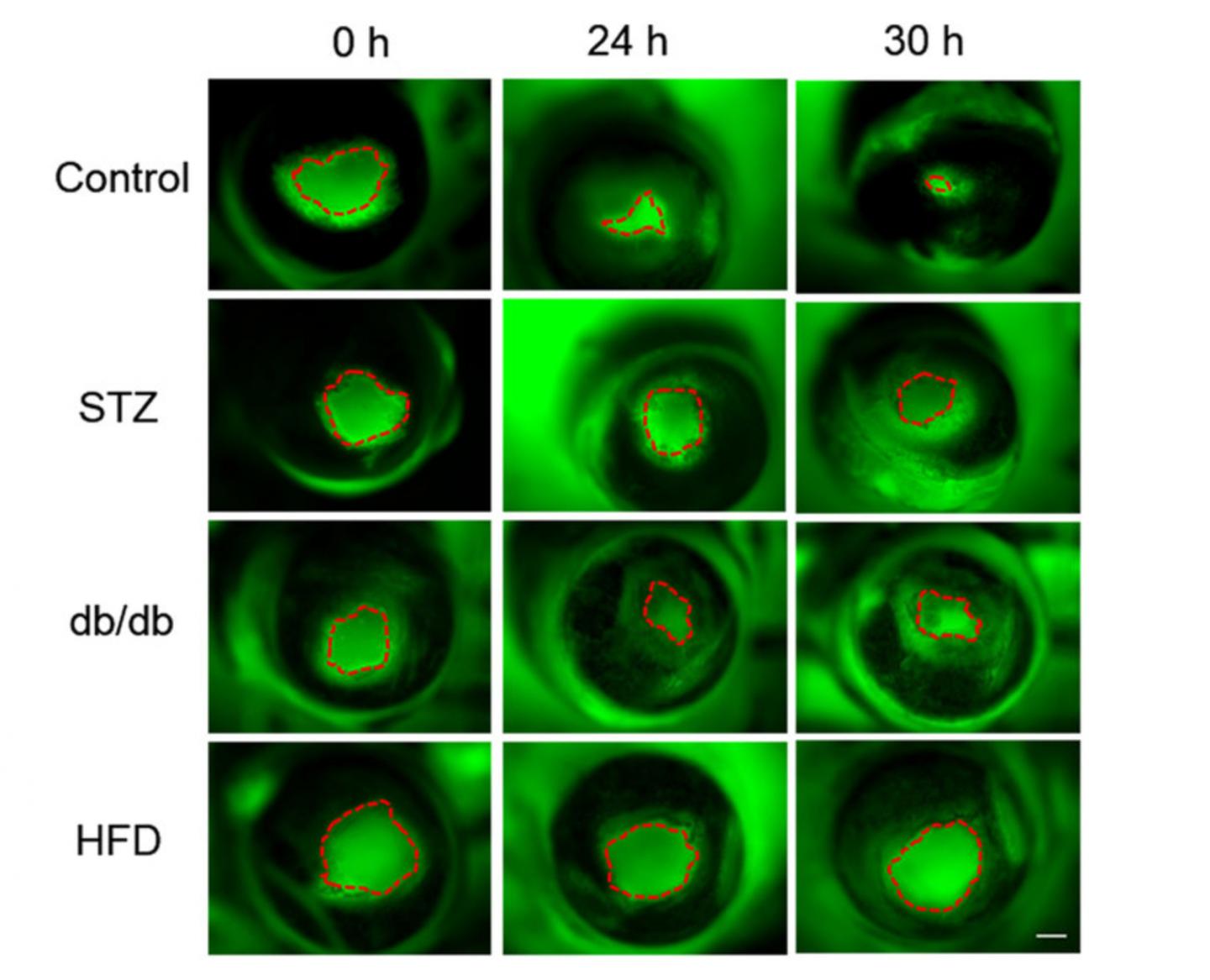 Electric Fields and Wound Healing in Mouse Models of Diabetes