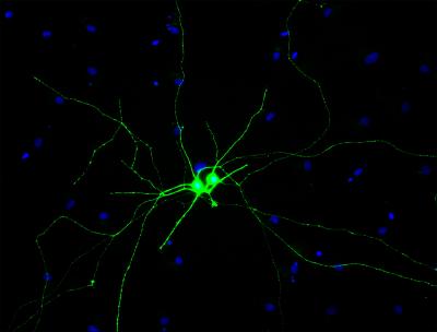 Retinal Ganglion Cells Derived from Human Pluripotent Stem Cells