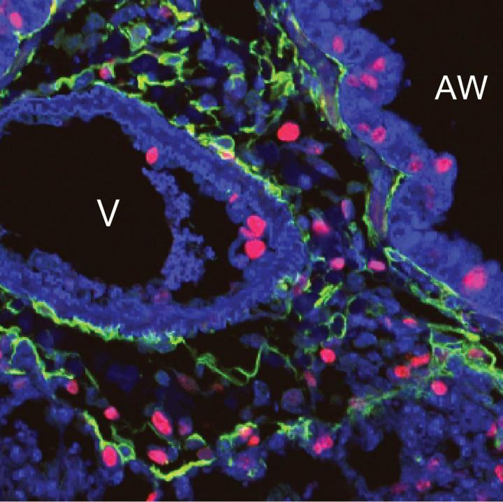 Lung Repair