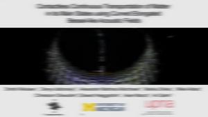 Video material