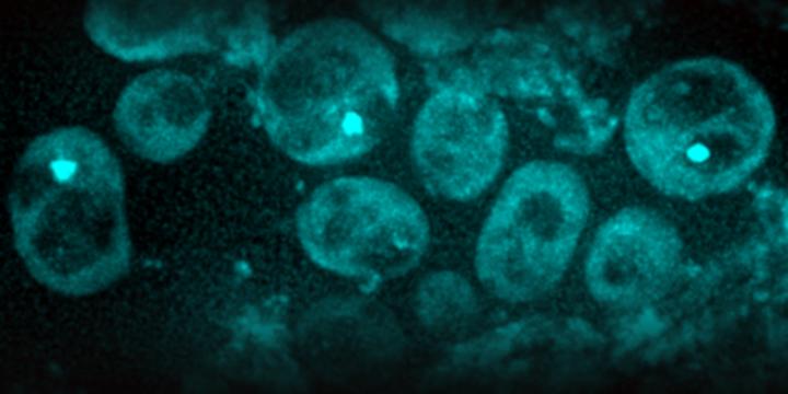 Yeast Cells