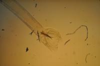 Back of <i>Haemonchus contortus</i> (Barber Pole) Worm
