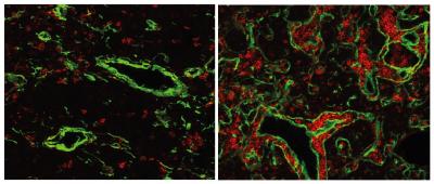 Immune System Thymus