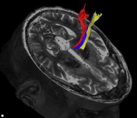 Brain
