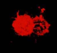 Two Cancer Cells Attaching