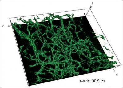 Human Vascular System in Mice (1 of 2)