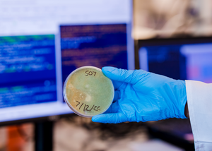 Petri Dish Growth
