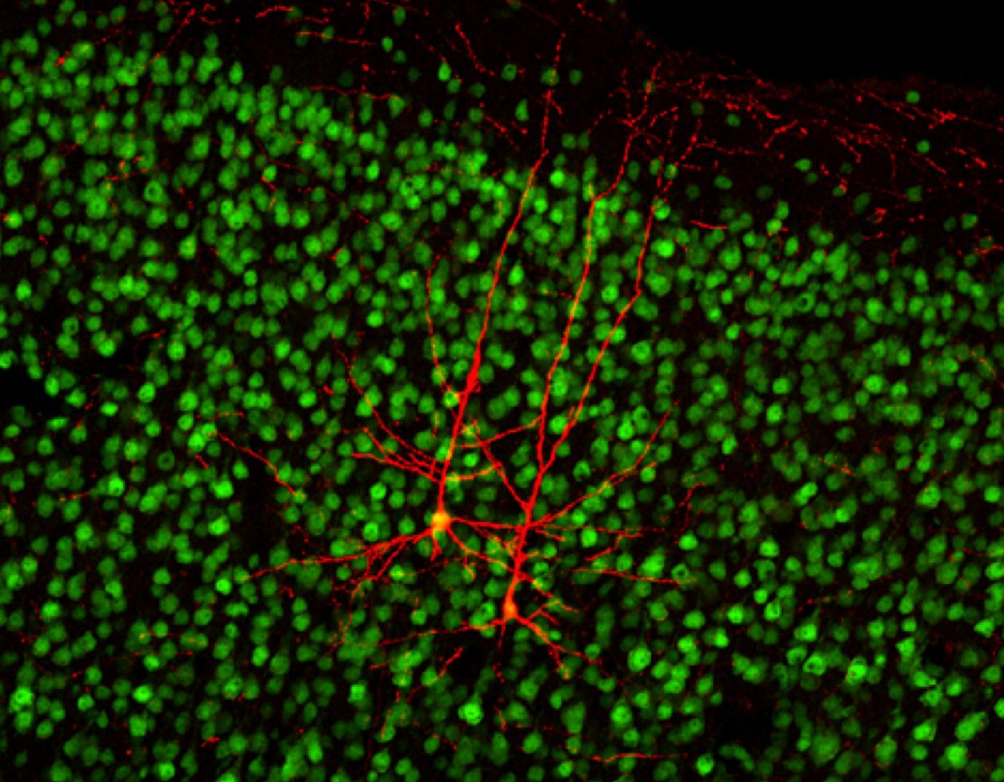 Microscopic View of The Brain