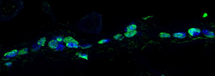 DNA Damage in Mice Skin