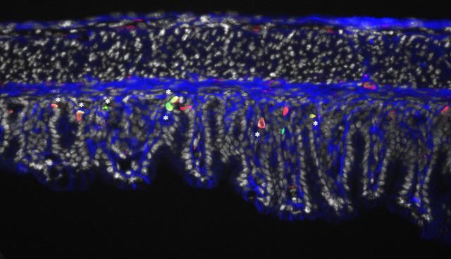 Percc1 Detection