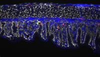 Percc1 Detection