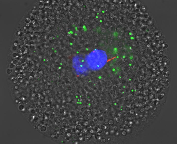 Mitophagy