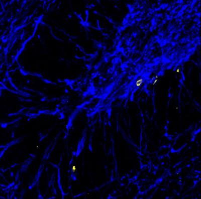 Myelin Staining in Hippocampus