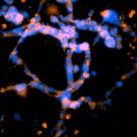 Cellular Networks Stained for the Presence of Basement Membrane Proteins