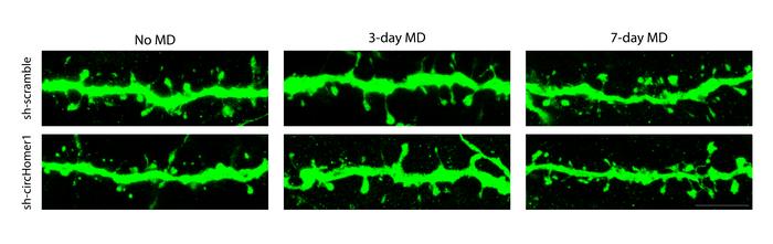 Synapses on dendrites