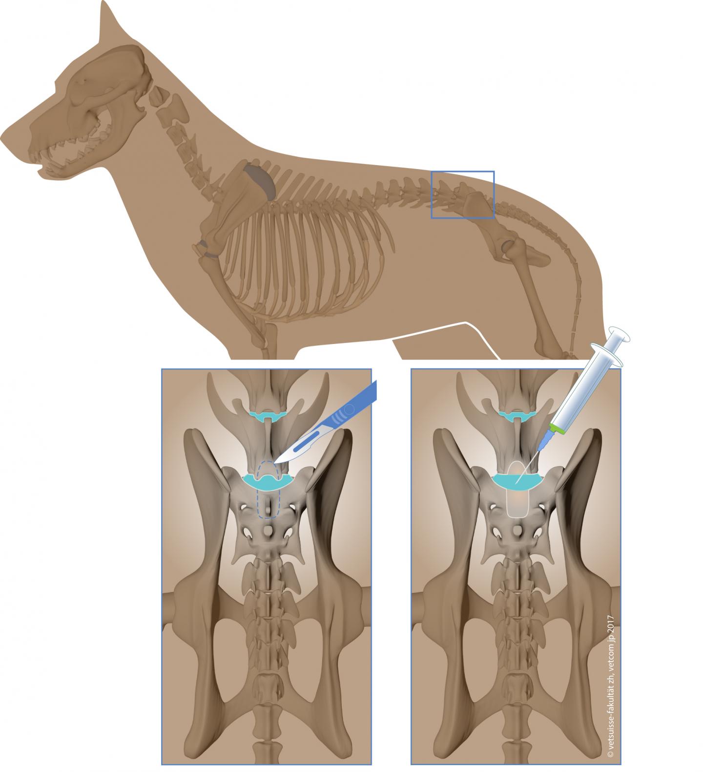 With Stem Cells to New Intervertebral Discs
