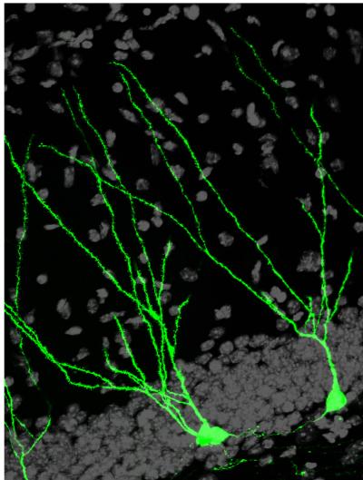Newborn Brain Cells Show the Way (1 of 2)