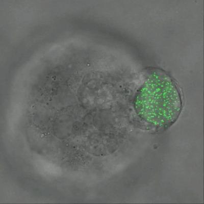 Microgel Sphere in Action