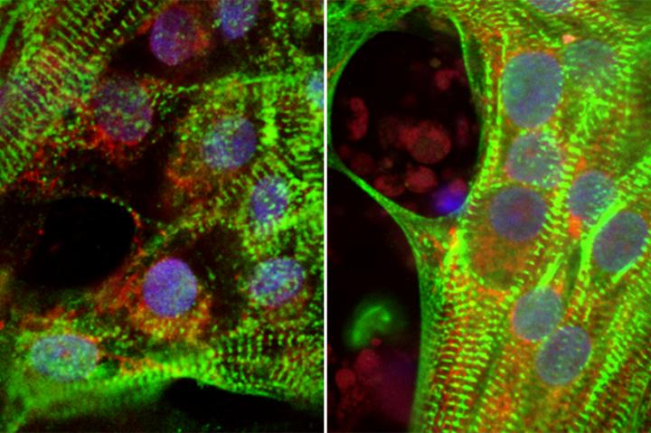 Human Heart Cells Grown from Stem Cells in High And Reduced Glucose Conditions