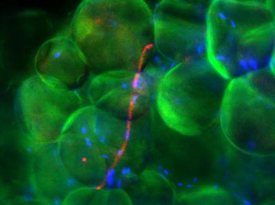 Fat Cells
