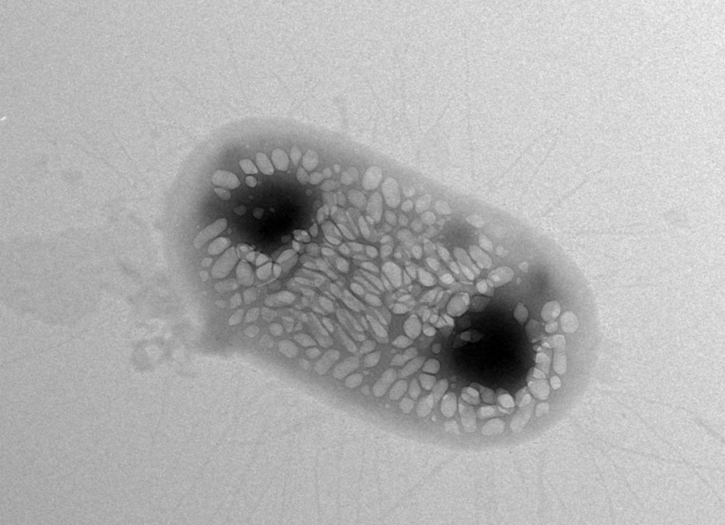 Bacteria Designed to Reflect Sound Waves