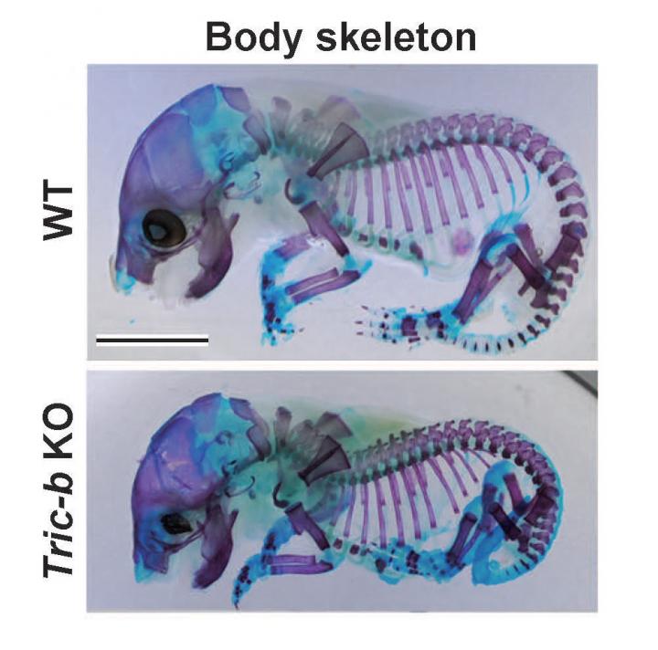 Genetic Mutation in Brittle Bone Disease Linked to Collagen Defects