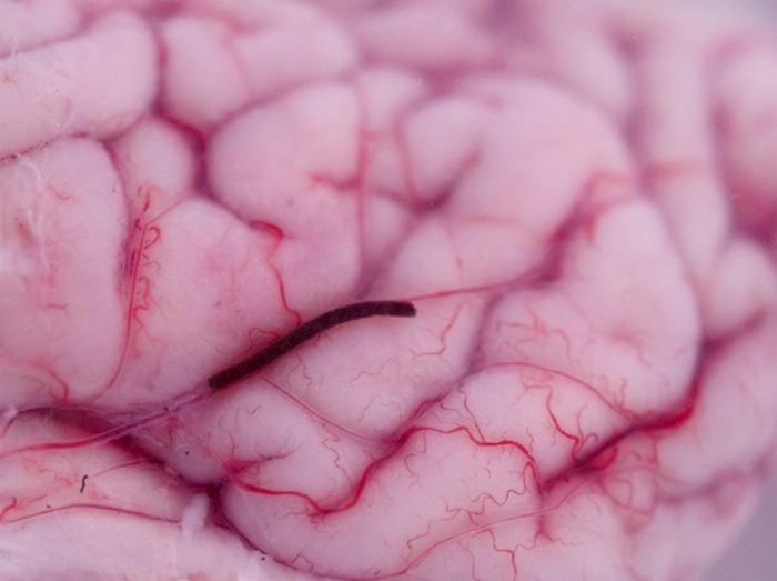 The BBHFs moving over in vitro porcine cerebral cortex
