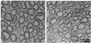 Lithium deficiency thins myelin sheaths