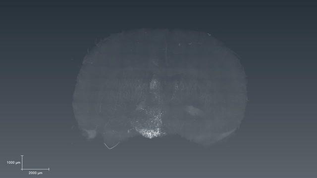 Brain Networks Involved in Drive to Stop or Keep Feeding