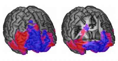 Frontal Lobes