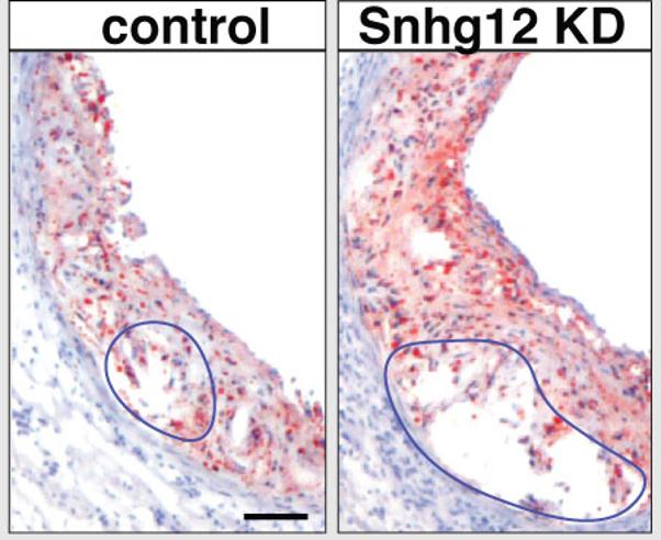 Protecting Blood Vessels in Atherosclerosis from the Ravages of DNA Damage (1 of 2)