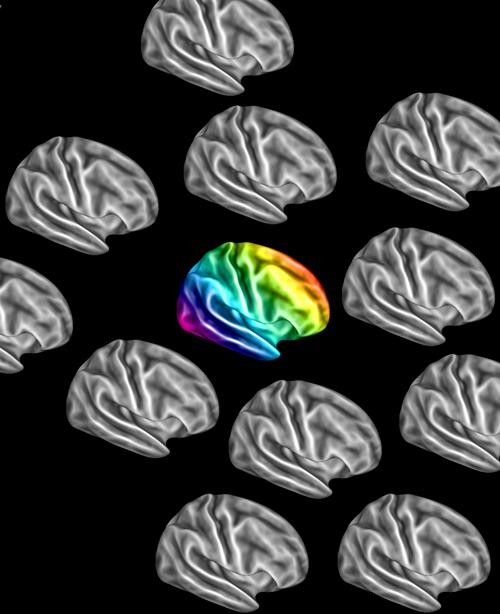 Autistic Brains