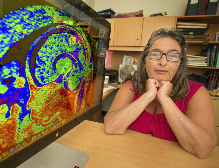 Anat Biegon, Ph.D., Stony Brook University
