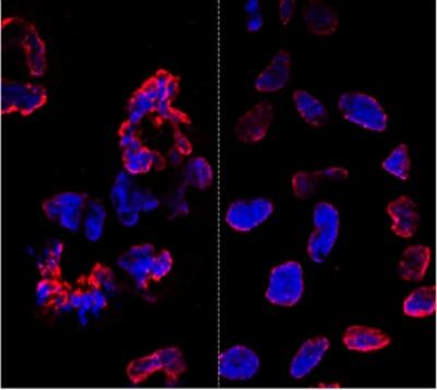 Gene-Editing Comparison