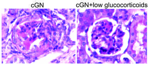 The left image shows a section of a kidney biopsy of a mouse with crescentic glomerulonephritis (cGN), featuring a damaged glomerulus. The right image shows less glomerular injury in a nephritic mouse receiving low dose glucocorticoid treatment.