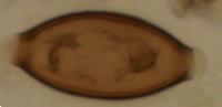 Whipworm Egg