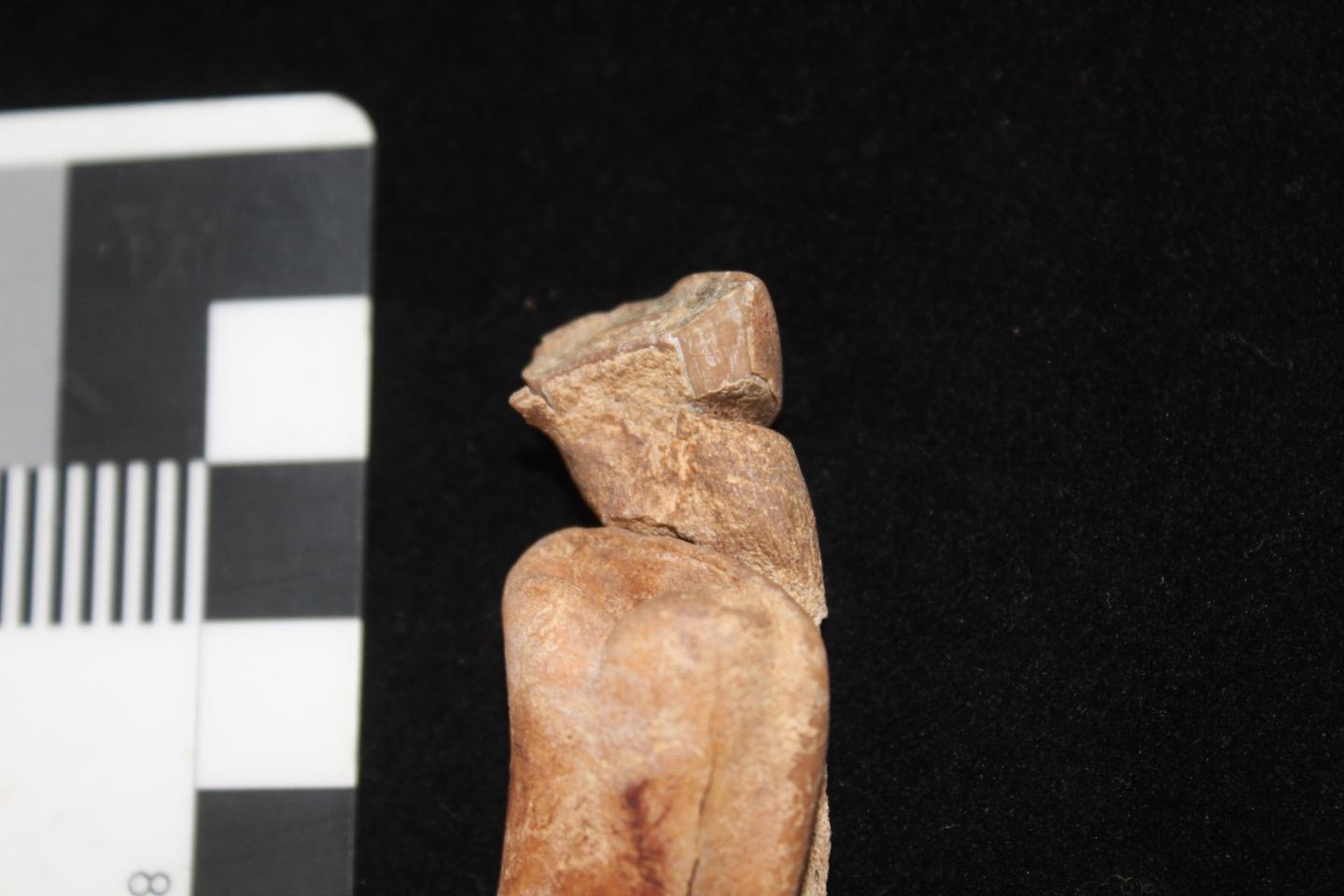 First Incisor 