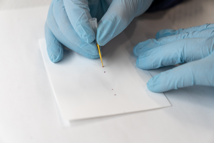 Salmonella test close-up