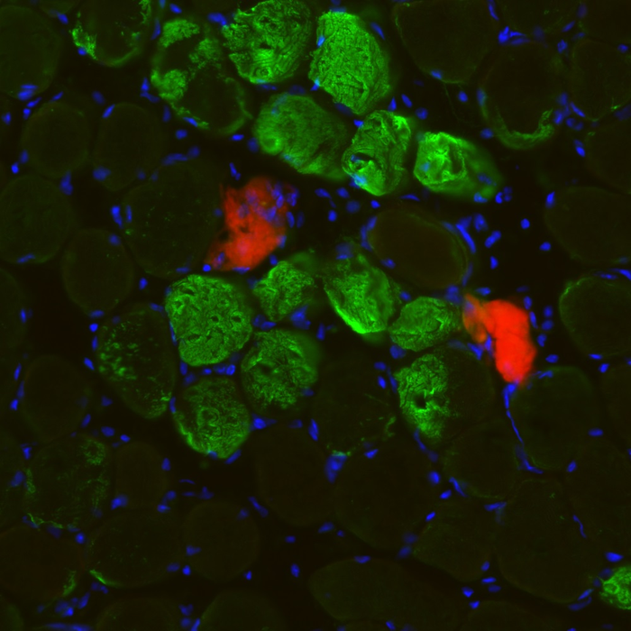 Local damage to muscle fibers after exercise