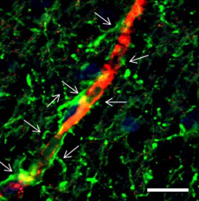 Astrocytes