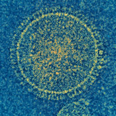 Respiratory Syncytial Virus
