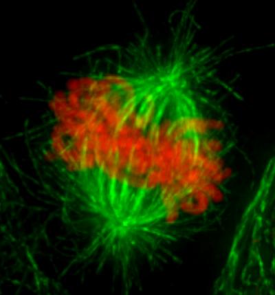Metaphase in a Human Cervical Carcinoma (HeLa) Cell
