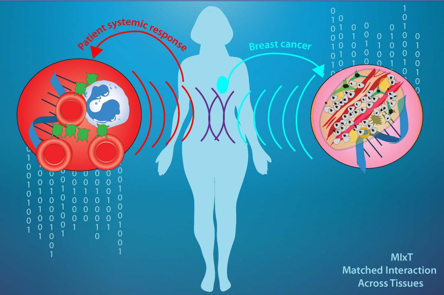Molecular Fingerprint of Breast Tumors Linked to Immune Response in Bloodstream
