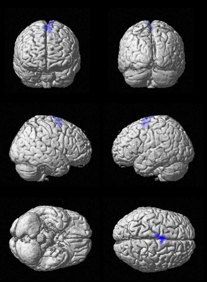 Brain Activation