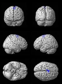 Brain Activation