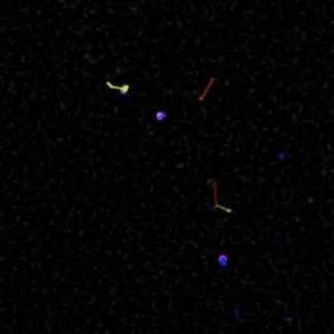 SRF3 molecules show dynamic movement in Arabidopsis